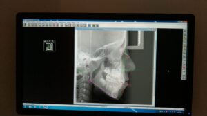 immagine radiologia digitale TC cone beam