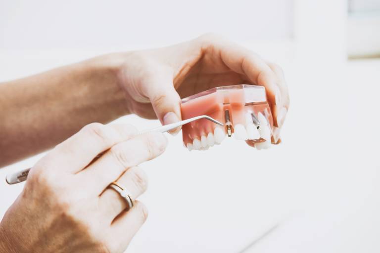 specillo su prova impianto dentale