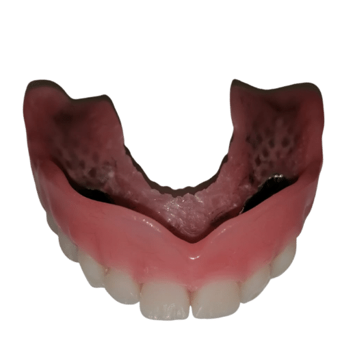 dentiera senza palato su barra