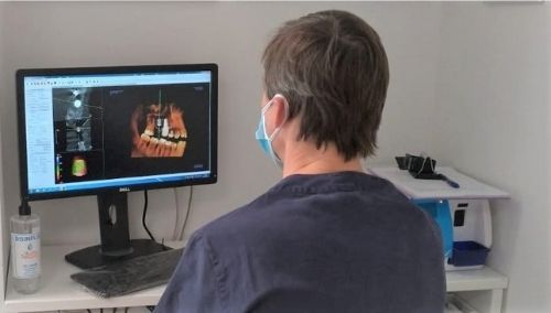 medico che controlla panoramica con impianti su schermo