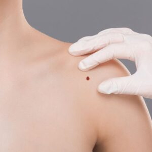 visite dermatologiche nei