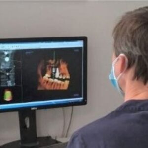 Implantologia dentale: dentista studia radiografia digitale su monitor a Lecco