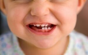 dentizione, bimbo che sorride
