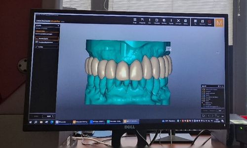 studio del provvisorio su pc